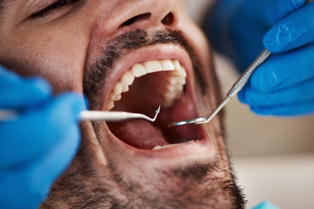 Best Emergency Treatment for Dental Infections or Abscesses in St Helena, CA